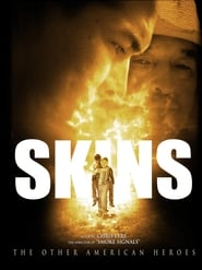 Skins